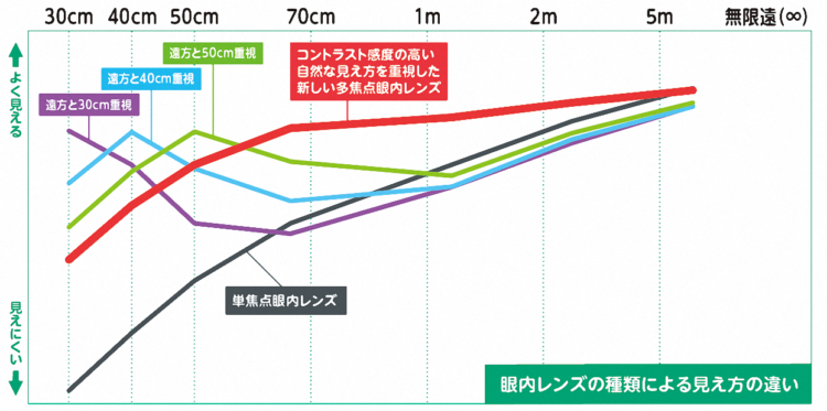 眼内レンズの種類による見え方の違い